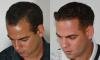 Hair Grafting, Dentistry & Plastic Surgery Centre