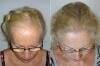 Hair Grafting, Dentistry & Plastic Surgery Centre